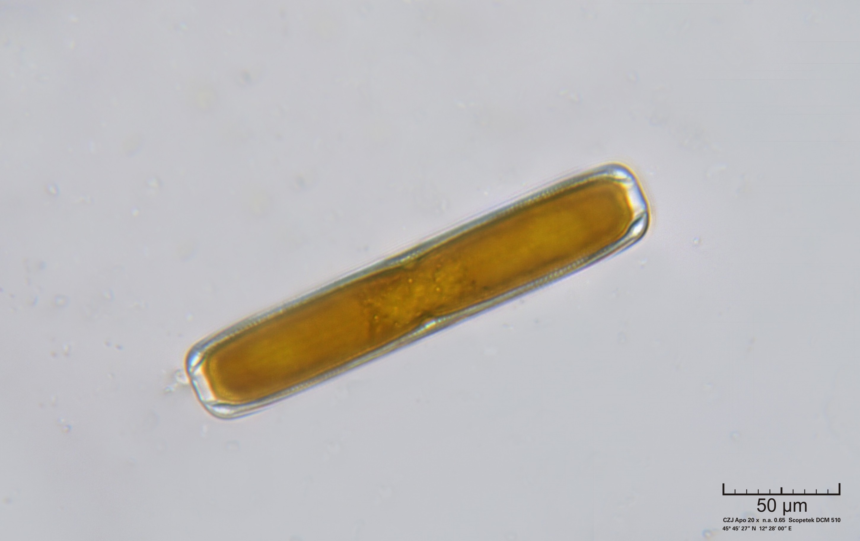 Pinnularia
